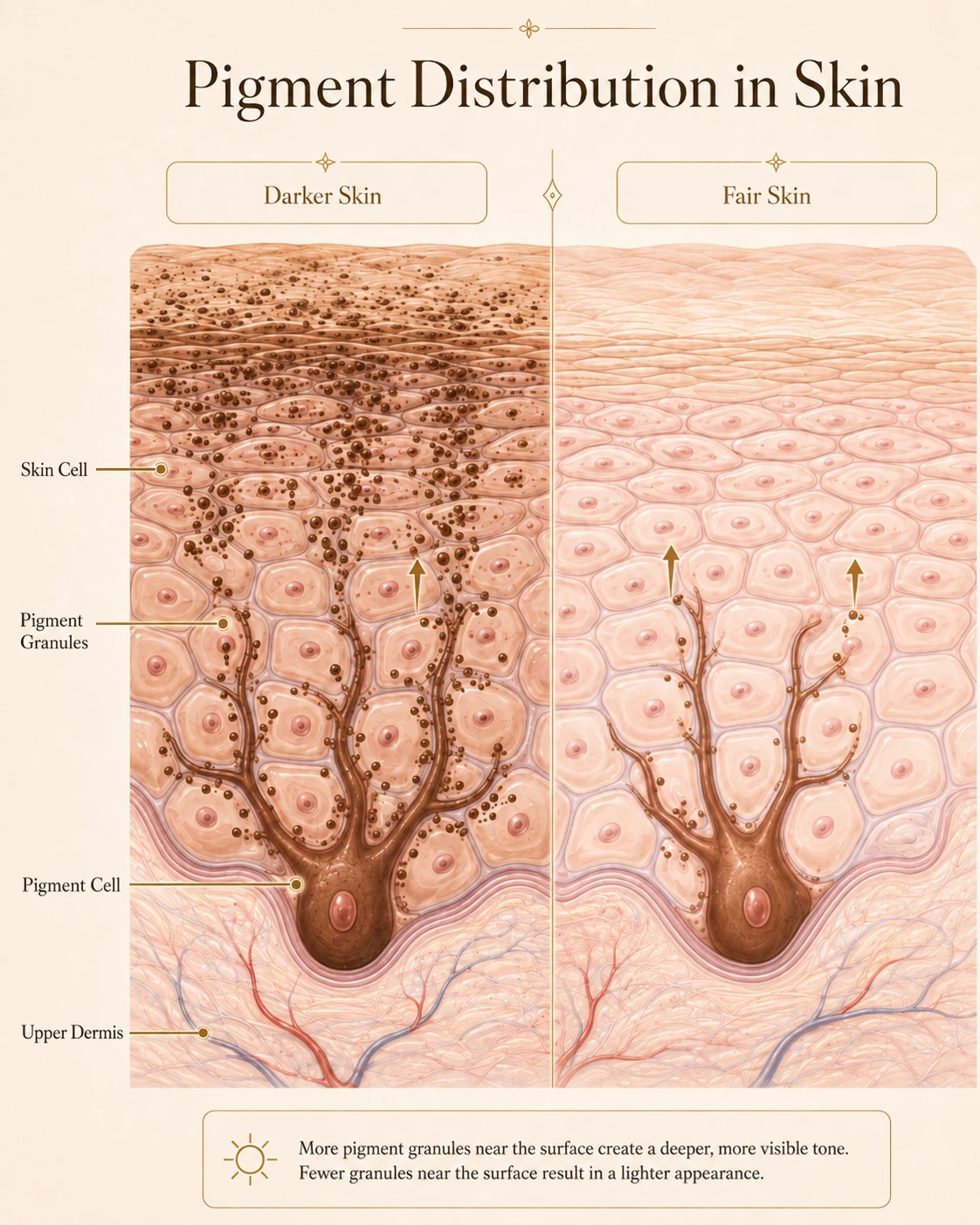Cross-section diagram comparing pigment distribution in darker skin and fair skin, showing a pigment cell at the base of the epidermis sending pigment granules up into the surrounding skin cells