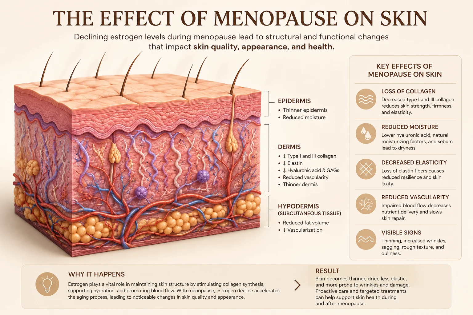 Cross-section diagram of skin showing the effects of falling oestrogen on the epidermis, dermis and fat layer, including reduced collagen, elastin, moisture and blood supply