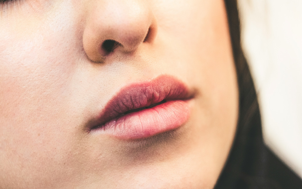 Transform Your Look with Lip and Cheek Fillers in Teneriffe and New Farm