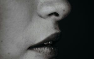 Nose and Chin Fillers in Hamilton and Bulimba